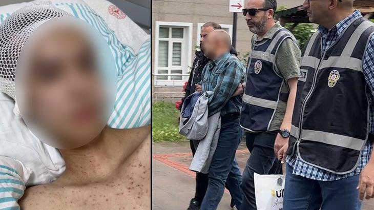 Komadan çıktı, her şeyi anlattı! Tacize direndiği iddiasıyla başından vurulan çocuk felç kaldı