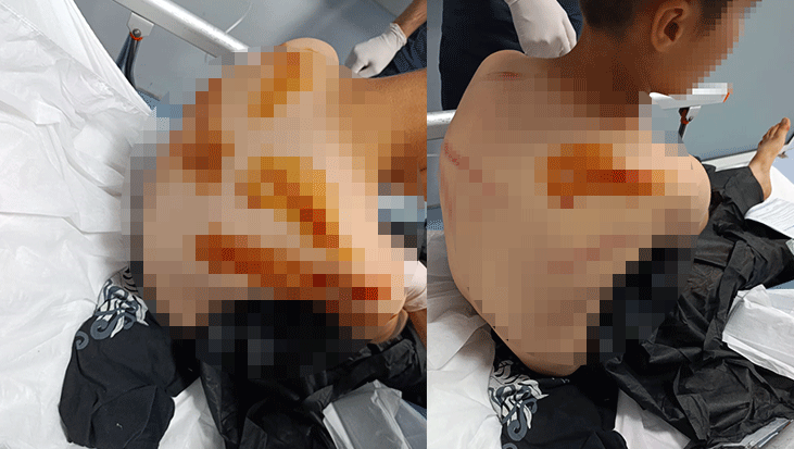 Şanlıurfa'da komşu dehşeti! 11 yaşındaki çocuğu sokak ortasında sopayla öldüresiye darbetti