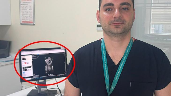 Zayıflamak uğruna kendine bunu yaptı! İstanbul'da doktorların inanamadığı vaka